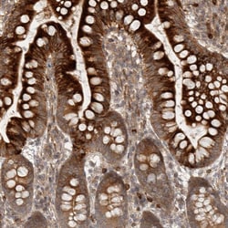 Invitrogen CCPG1 Polyclonal Antibody 100 &mu;L; Unconjugated:Antibodies,