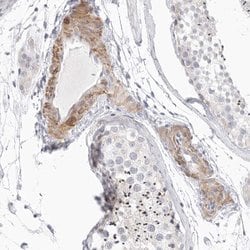 Invitrogen Stabilin 2 Polyclonal Antibody 100 &mu;L; Unconjugated:Antibodies,