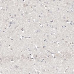Invitrogen Stabilin 2 Polyclonal Antibody 100 &mu;L; Unconjugated:Antibodies,