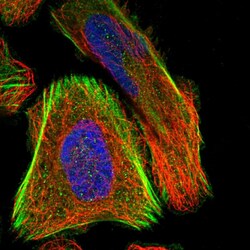 Invitrogen SCNN1D Polyclonal Antibody 100 &mu;L; Unconjugated:Antibodies,