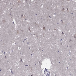 Invitrogen SCNN1D Polyclonal Antibody 100 &mu;L; Unconjugated:Antibodies,