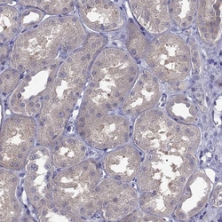 Invitrogen SCNN1D Polyclonal Antibody 100 &mu;L; Unconjugated:Antibodies,