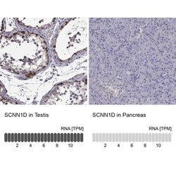 Invitrogen SCNN1D Polyclonal Antibody 100 &mu;L; Unconjugated:Antibodies,