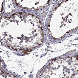 Invitrogen SCNN1D Polyclonal Antibody 100 &mu;L; Unconjugated:Antibodies,