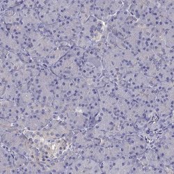 Invitrogen SCNN1D Polyclonal Antibody 100 &mu;L; Unconjugated:Antibodies,