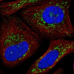 Invitrogen SLC25A26 Polyclonal Antibody 100 &mu;L; Unconjugated:Antibodies,
