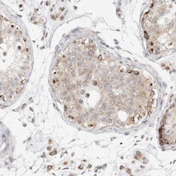 Invitrogen SLC25A26 Polyclonal Antibody 100 &mu;L; Unconjugated:Antibodies,