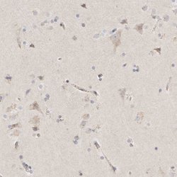Invitrogen SLC25A26 Polyclonal Antibody 100 &mu;L; Unconjugated:Antibodies,