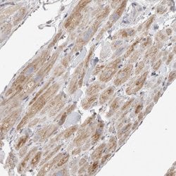 Invitrogen SLC25A26 Polyclonal Antibody 100 &mu;L; Unconjugated:Antibodies,