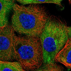 Invitrogen NCEH1 Polyclonal Antibody 100 &mu;L; Unconjugated:Antibodies,