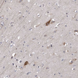 Invitrogen NCEH1 Polyclonal Antibody 100 &mu;L; Unconjugated:Antibodies,