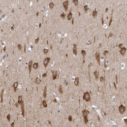 Invitrogen NCEH1 Polyclonal Antibody 100 &mu;L; Unconjugated:Antibodies,