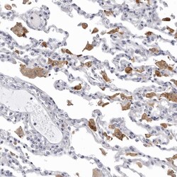 Invitrogen NCEH1 Polyclonal Antibody 100 &mu;L; Unconjugated:Antibodies,