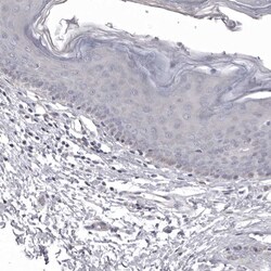 Invitrogen NCEH1 Polyclonal Antibody 100 &mu;L; Unconjugated:Antibodies,