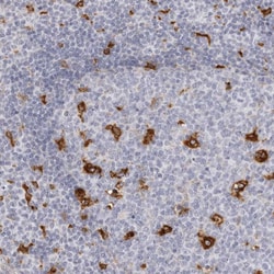 Invitrogen NCEH1 Polyclonal Antibody 100 &mu;L; Unconjugated:Antibodies,