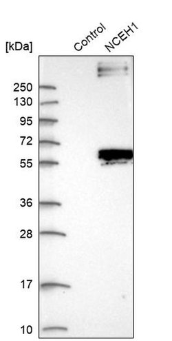 Invitrogen NCEH1 Polyclonal Antibody 100 &mu;L; Unconjugated:Antibodies,