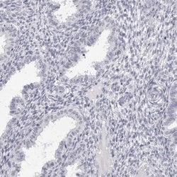 Invitrogen SMIM2 Polyclonal Antibody 100 &mu;L; Unconjugated:Antibodies,