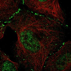 Invitrogen WDR8 Polyclonal Antibody 100 &mu;L; Unconjugated:Antibodies,