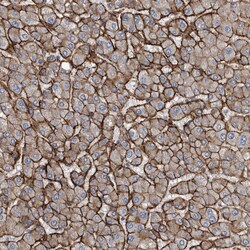Invitrogen GLT8D2 Polyclonal Antibody 100 &mu;L; Unconjugated:Antibodies,