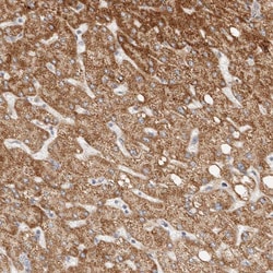 C12orf49 Polyclonal Antibody 100 &mu;L | Buy Online | Thermo Scientific | Fisher Scientific