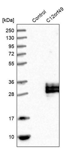 C12orf49 Polyclonal Antibody 100 &mu;L | Buy Online | Thermo Scientific | Fisher Scientific