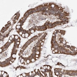Invitrogen TMPRSS11F Polyclonal Antibody 100 &mu;L; Unconjugated:Antibodies,