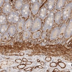 Invitrogen TMTC2 Polyclonal Antibody 100 &mu;L; Unconjugated:Antibodies,