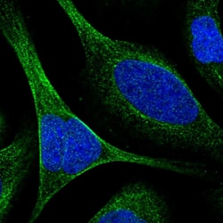 Invitrogen TCTN3 Polyclonal Antibody 100 &mu;L; Unconjugated:Antibodies,