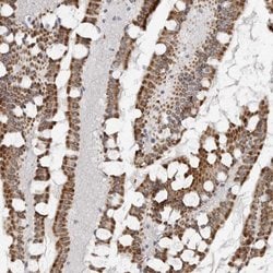 Invitrogen TCTN3 Polyclonal Antibody 100 &mu;L; Unconjugated:Antibodies,