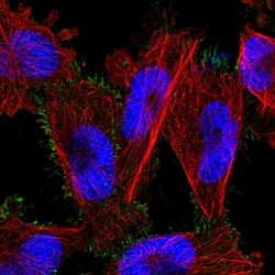 PARP6 Polyclonal Antibody:Antibodies, Polyclonal