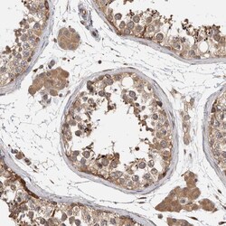 PARP6 Polyclonal Antibody:Antibodies, Polyclonal