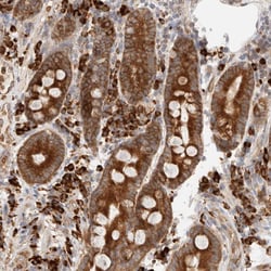 UTS2B Polyclonal Antibody:Antibodies, Polyclonal