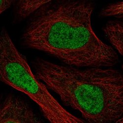 Invitrogen TMEM69 Polyclonal Antibody 100 &mu;L; Unconjugated:Antibodies,