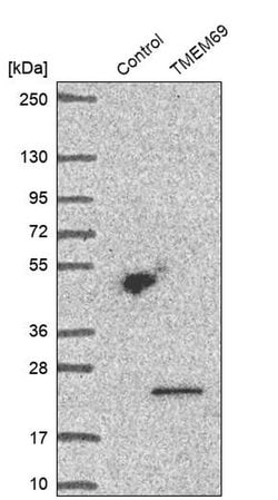 Invitrogen TMEM69 Polyclonal Antibody 100 &mu;L; Unconjugated:Antibodies,
