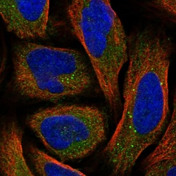 Invitrogen SRD5A3 Polyclonal Antibody 100 &mu;L; Unconjugated:Antibodies,