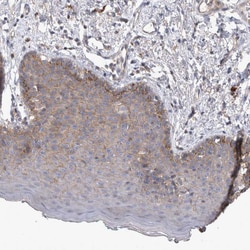 Invitrogen SRD5A3 Polyclonal Antibody 100 &mu;L; Unconjugated:Antibodies,