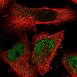 Invitrogen TMPPE Polyclonal Antibody 100 &mu;L; Unconjugated:Antibodies,