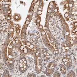 Invitrogen TMPPE Polyclonal Antibody 100 &mu;L; Unconjugated:Antibodies,