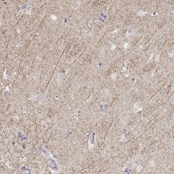 Invitrogen Kir2.2 (KCNJ12) Polyclonal Antibody 100 &mu;L; Unconjugated:Antibodies,