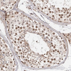 ZNF318 Polyclonal Antibody:Antibodies, Polyclonal
