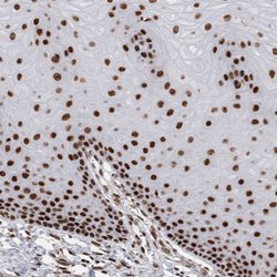 Invitrogen EYA2 Polyclonal Antibody 100 &mu;L; Unconjugated:Antibodies,