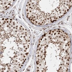 Invitrogen EYA2 Polyclonal Antibody 100 &mu;L; Unconjugated:Antibodies,