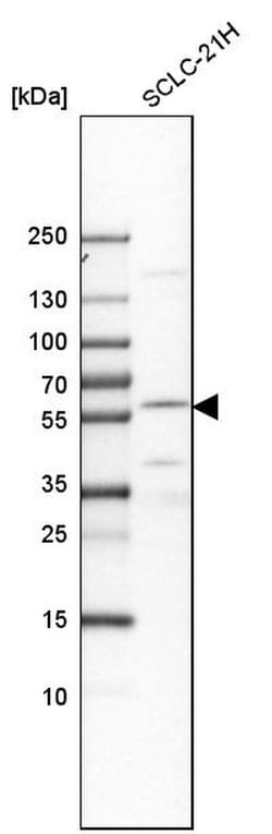 Invitrogen EYA2 Polyclonal Antibody 100 &mu;L; Unconjugated:Antibodies,