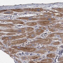 PPP1R3C Polyclonal Antibody:Antibodies, Polyclonal