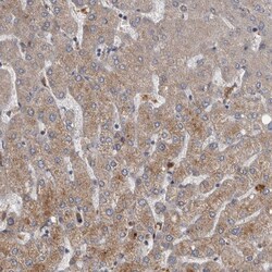 PPP1R3C Polyclonal Antibody:Antibodies, Polyclonal