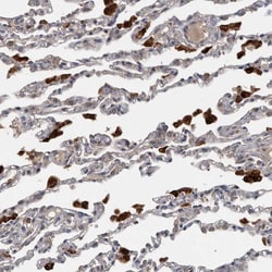 PPP1R3C Polyclonal Antibody:Antibodies, Polyclonal