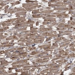 PPP1R3C Polyclonal Antibody:Antibodies, Polyclonal