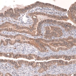 Invitrogen VANGL2 Polyclonal Antibody 100 &mu;L; Unconjugated:Antibodies,