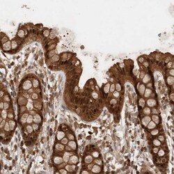 Invitrogen OTUD7B Polyclonal Antibody 100 &mu;L; Unconjugated:Antibodies,
