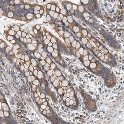 Invitrogen TMEM199 Polyclonal Antibody 100 &mu;L; Unconjugated:Antibodies,